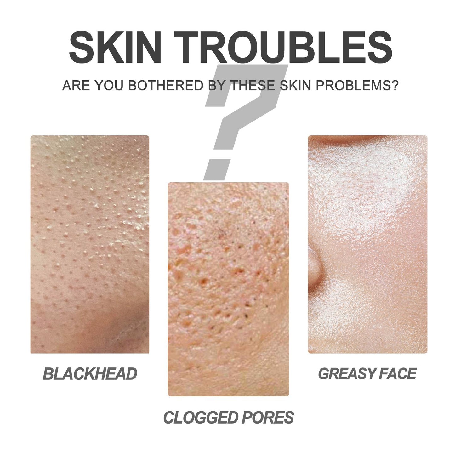 Blackhead Cleansing Cream Exfoliating, Cleaning and Repairing Pores Solve Skin Oil, Blackhead and Acne Problems Peel-Off Nose Patch