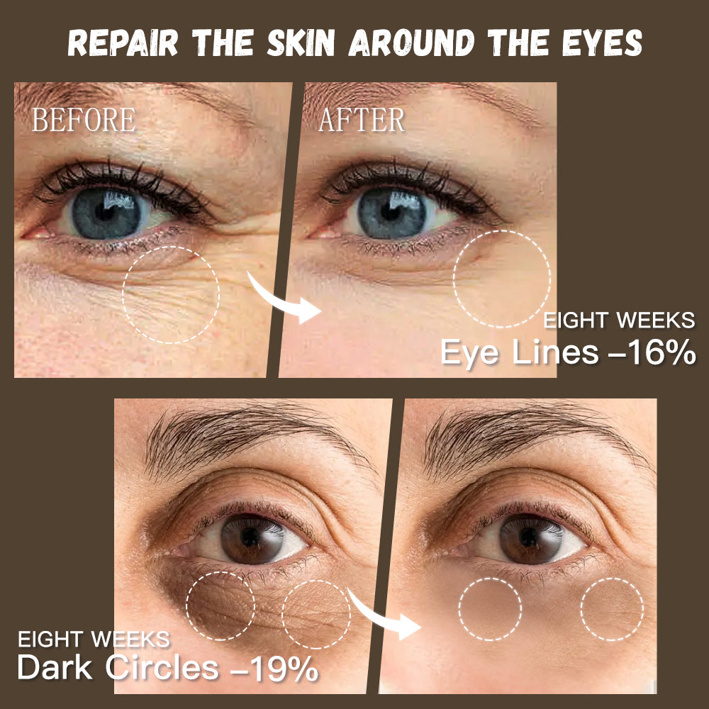 GUANJING Natural Skincare Retinol Eye Cream Vegan Organic anti Aging Moisturizer Anti-Wrinkle Skin Whitening Retinol Eye Cream