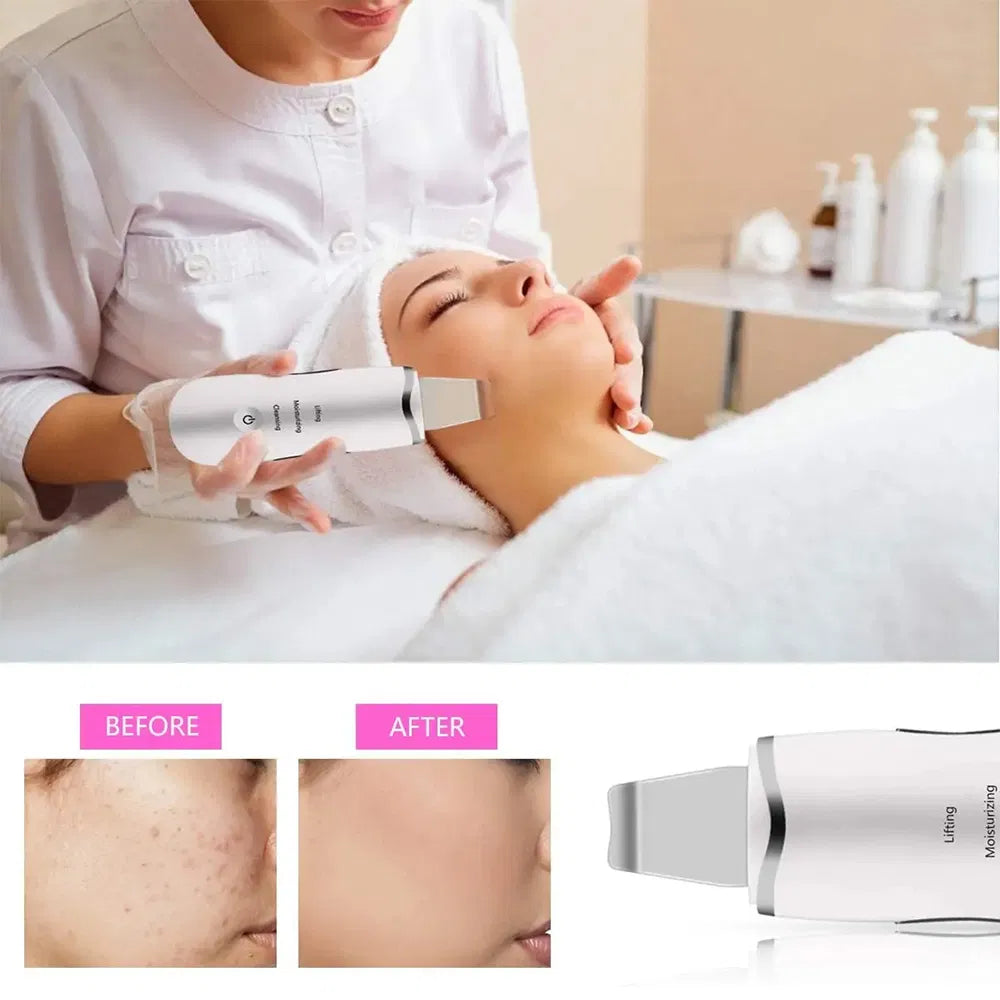 3-In-1 Ultrasonic Facial Spatula for Deep Cleansing, Electric Ultrasonic Skin Scrubber