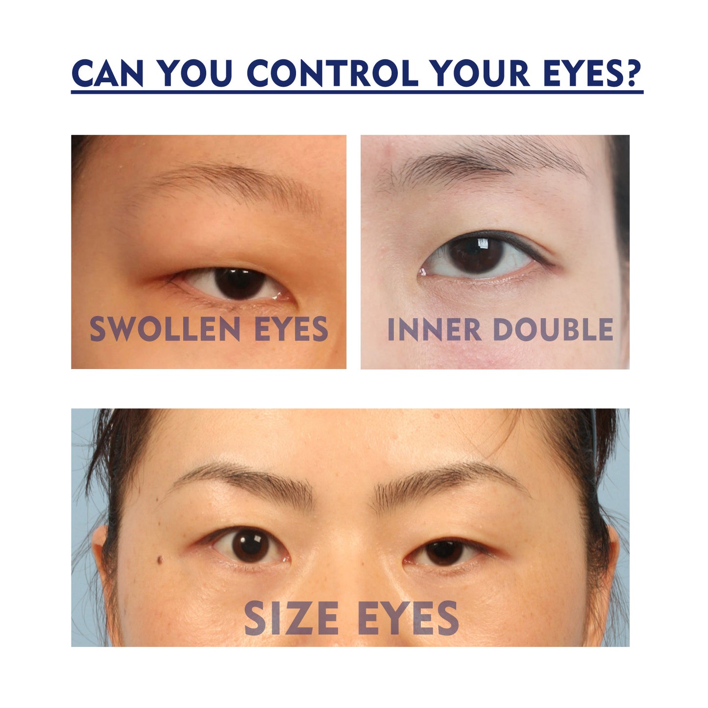 EELHOE Double Eyelid Fixing Cream - Traceless, Invisible, Long-Lasting, Waterproof, Firming, Natural, Quick-Drying Eye-Enlarging Beauty Eye Cream