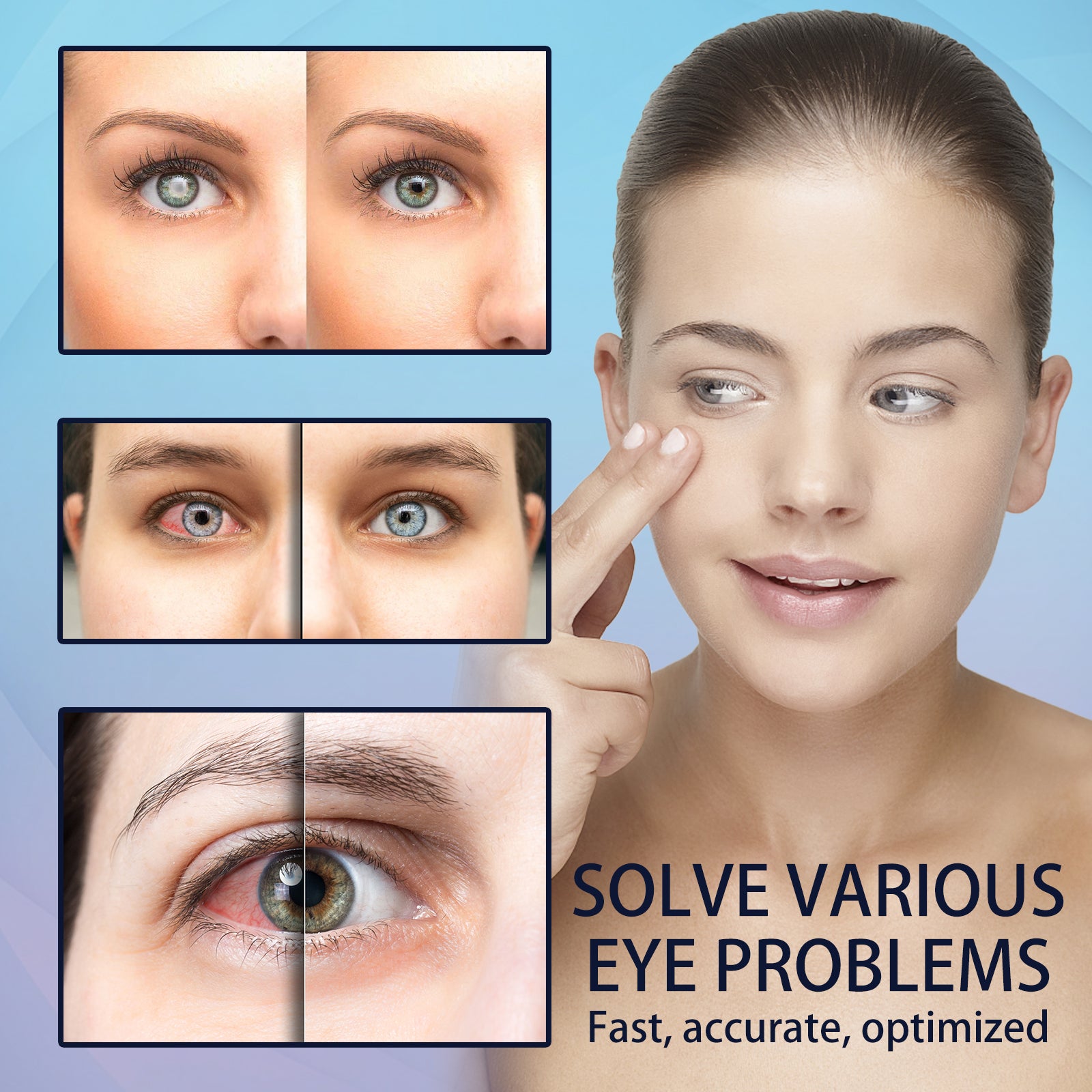 EELHOE Eye Drops Relieve Redness and Blurred Eyes Eye Fatigue Dryness Blurred Vision Moisturizing Eye Care Solution