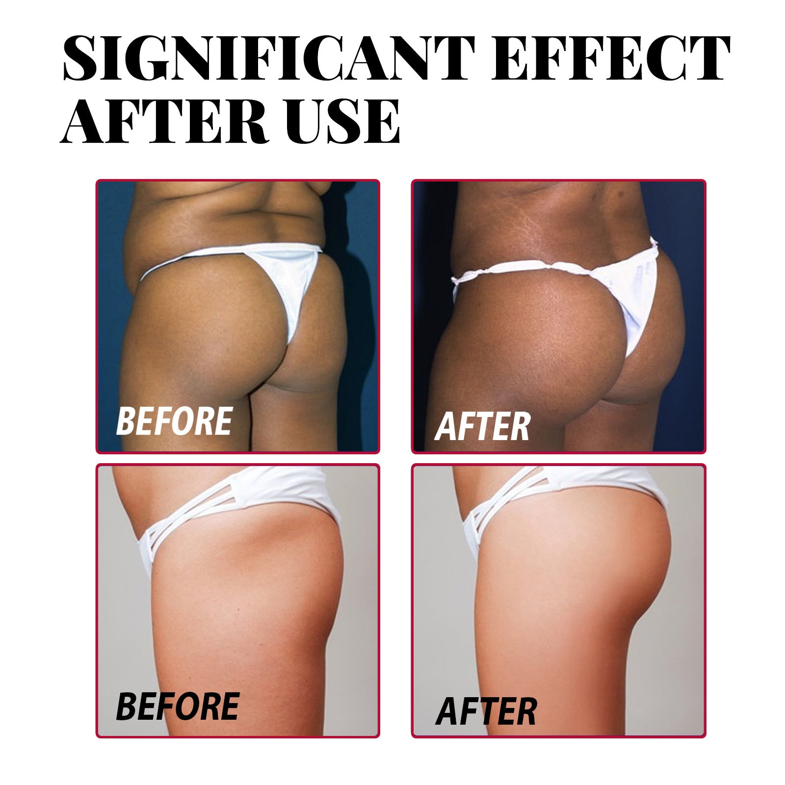 Plump Buttock Cream Lifts and Tightens Buttocks