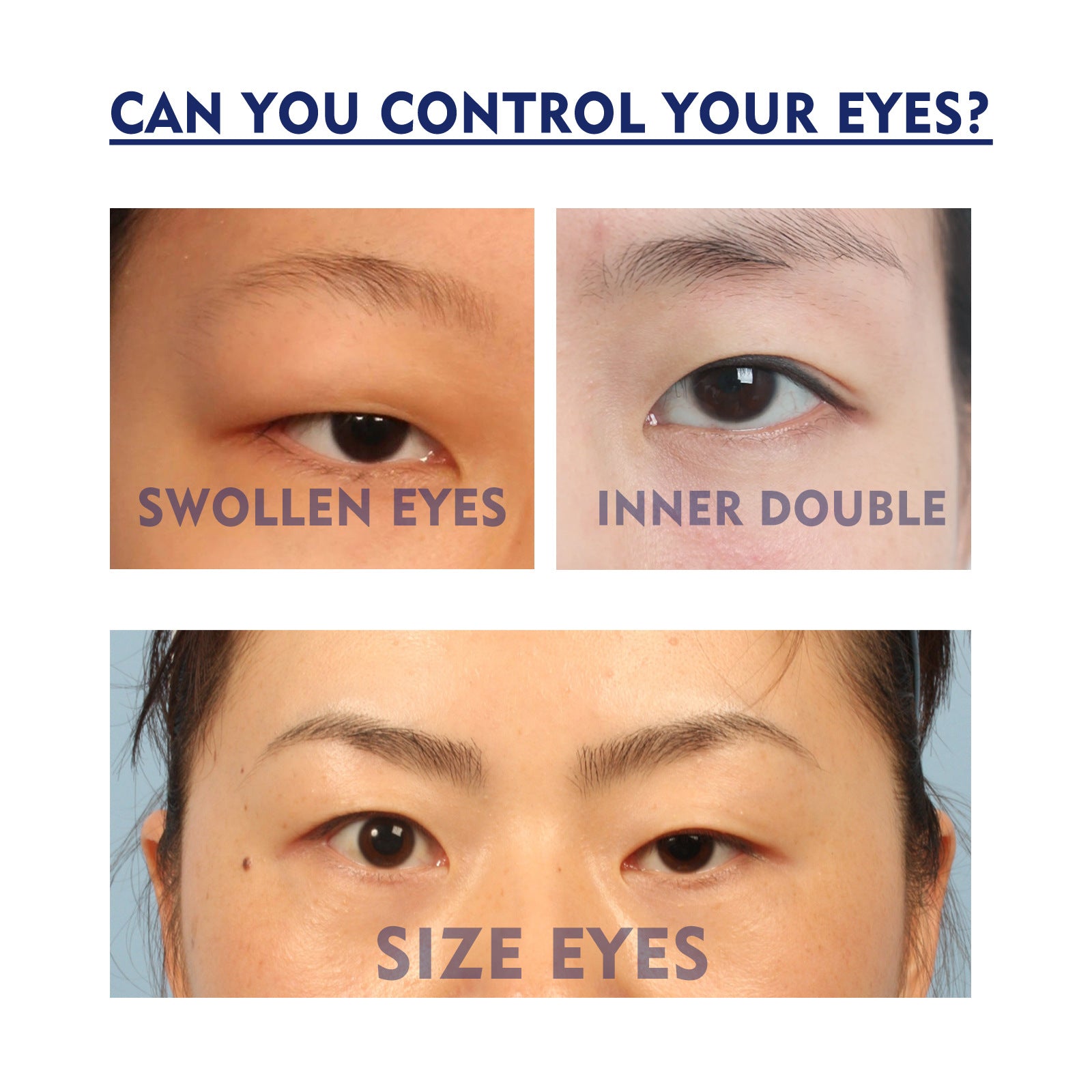 EELHOE Double Eyelid Fixing Cream - Traceless, Invisible, Long-Lasting, Waterproof, Firming, Natural, Quick-Drying Eye-Enlarging Beauty Eye Cream